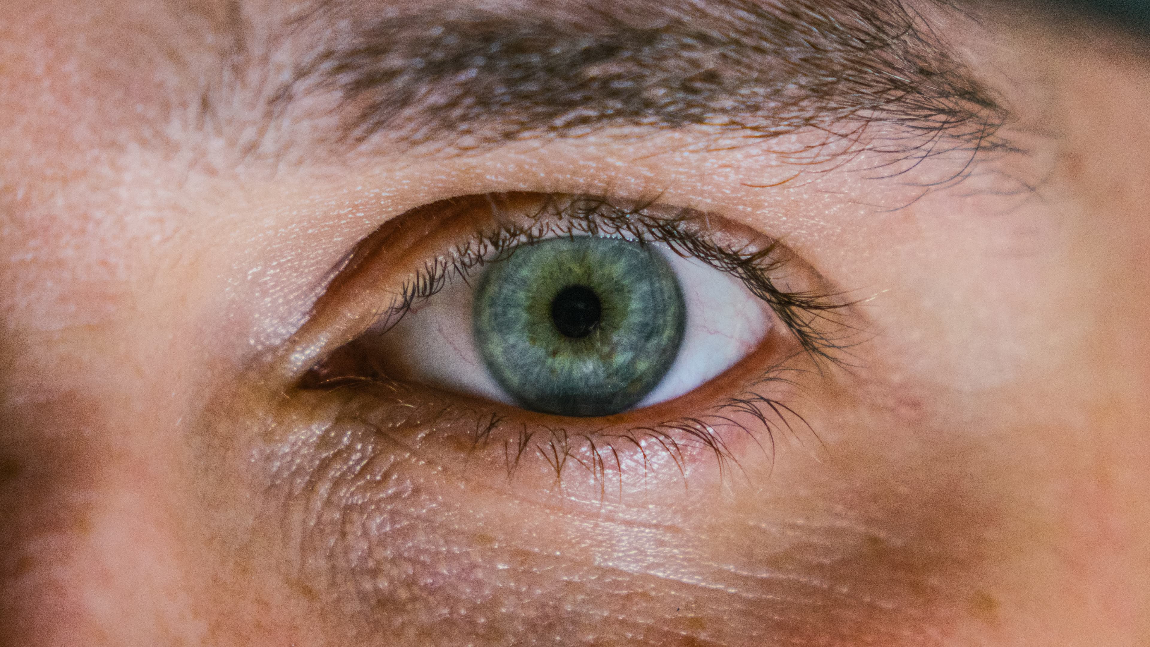 Oakland LASIK Eye Surgery - olive + spex optometry