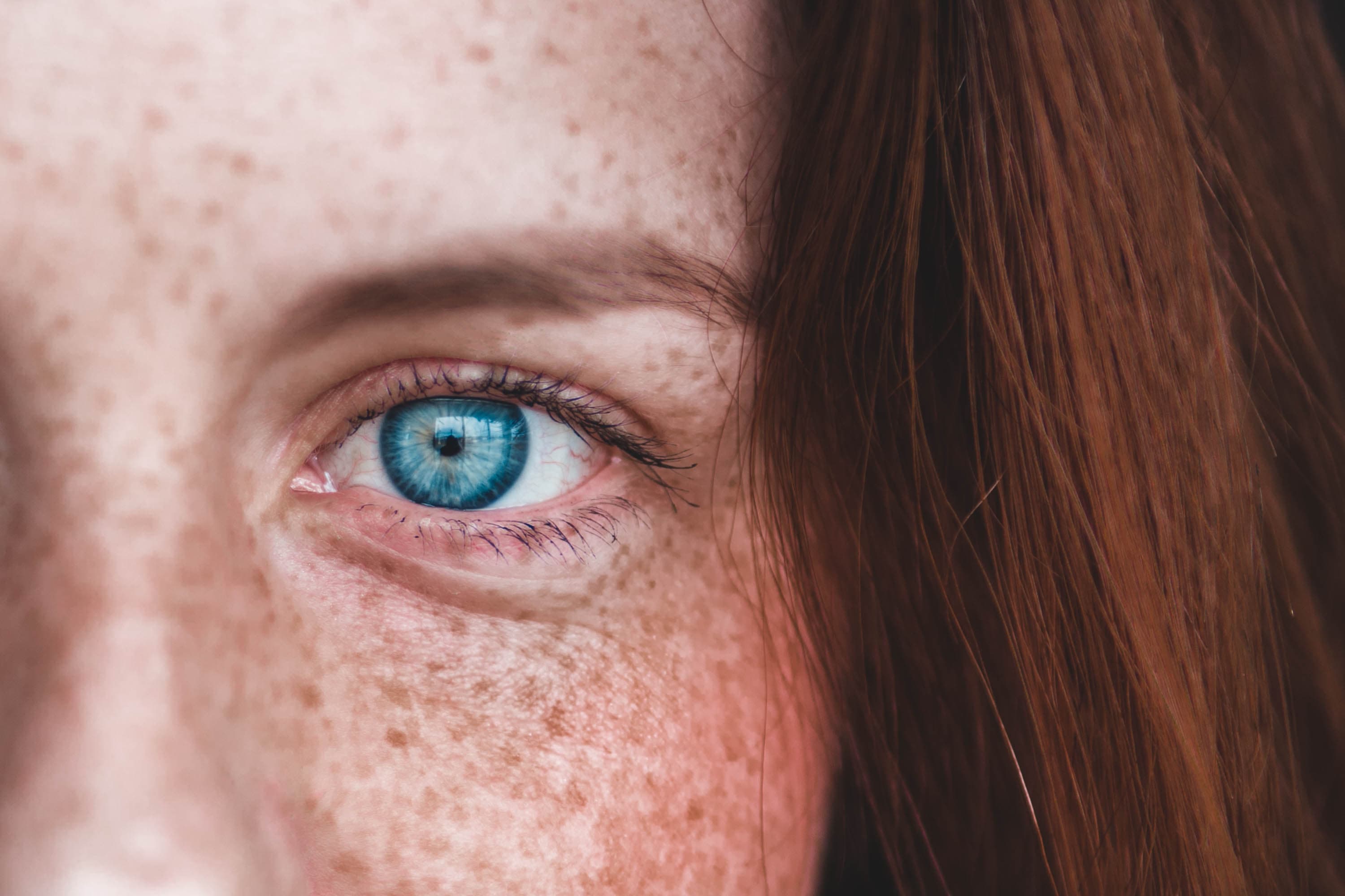 Oakland Laser Eye Surgery - olive + spex optometry